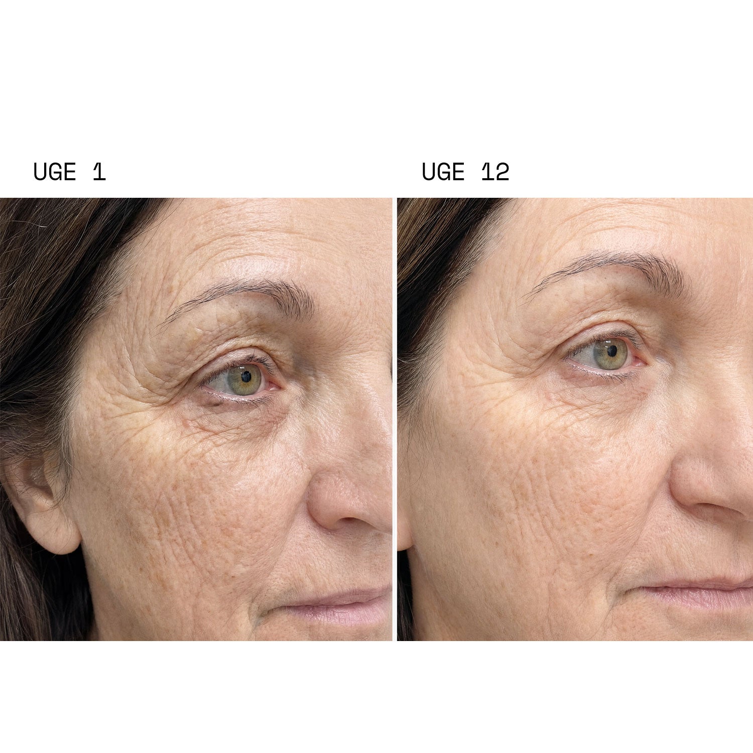 Collagen Tripeptides
